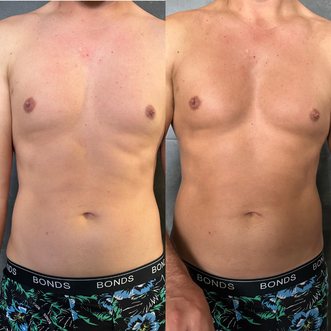 MEN'S TANNING PACK