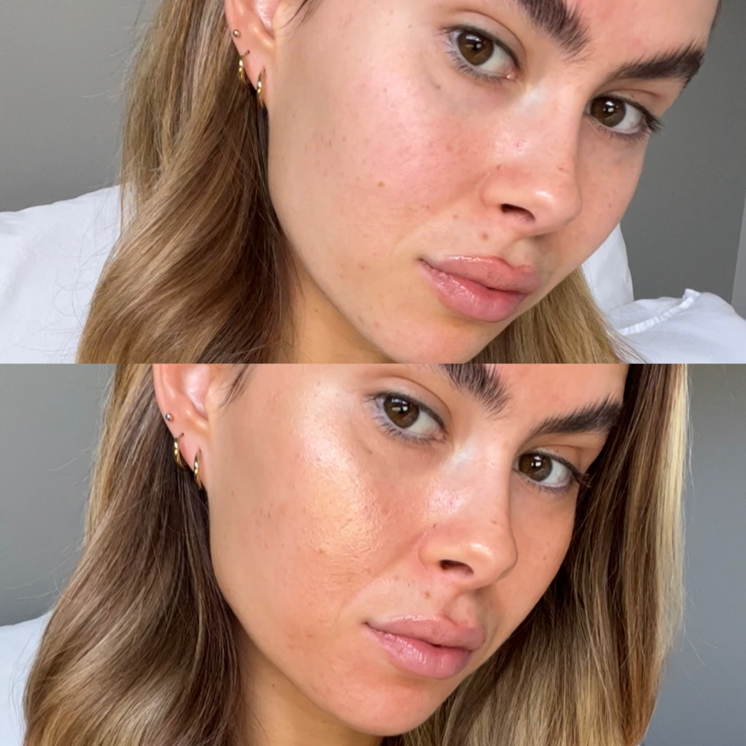 Skin First Glow Kit
