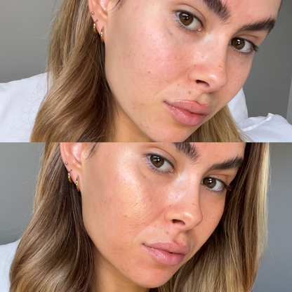 Skin First Glow Kit